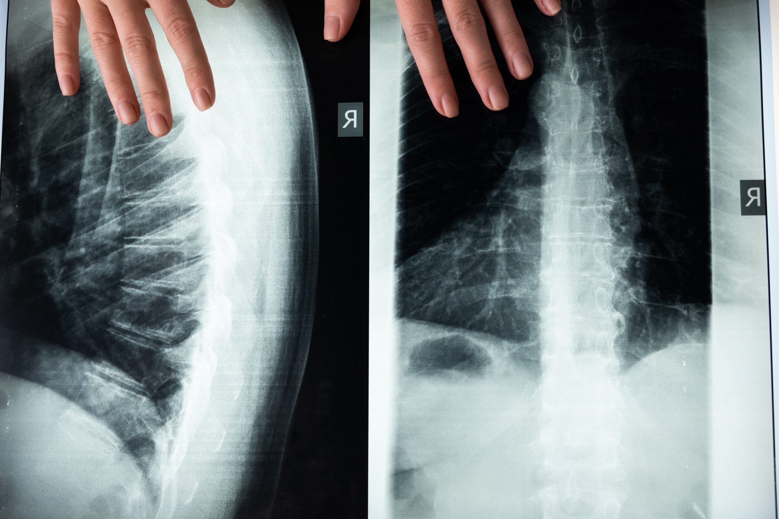 Röntgensjuksköterska: Allt om utbildning, lön och modern medicinsk teknik